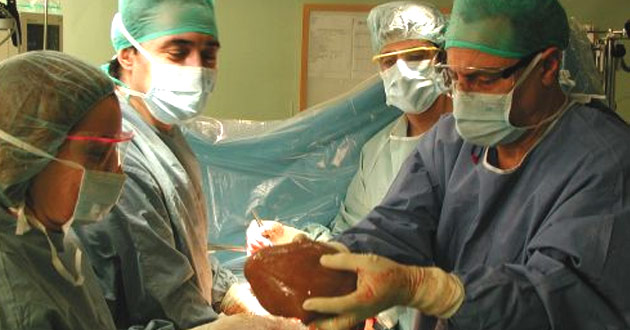 Autorizan La Creación De Fundación Para Trasplante De órganos